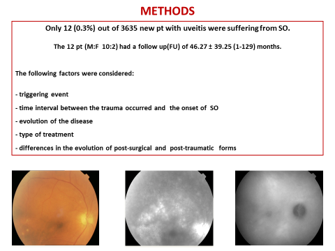 Sympathetic Ophthalmia3